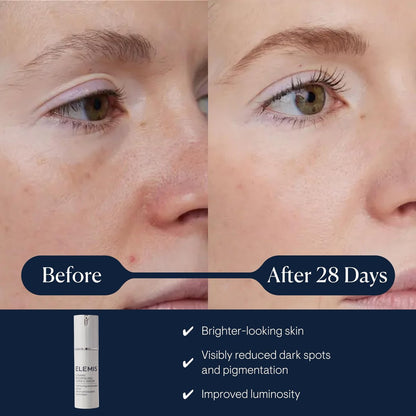 ELEMIS Dynamic Resurfacing Super-C Serum | Vitamin C Anti-Aging Serum for Brightening & Refining Skin Avelisse