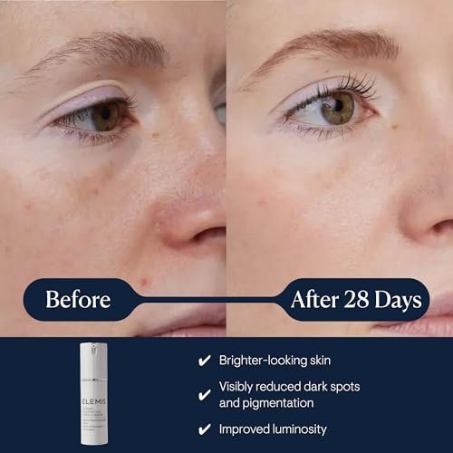 ELEMIS Dynamic Resurfacing Super-C Serum | Vitamin C Anti-Aging Serum for Brightening & Refining Skin Avelisse