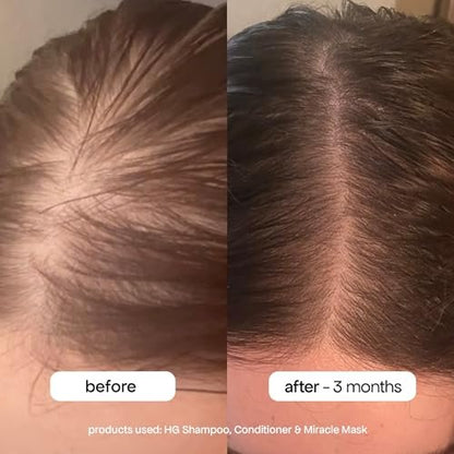 BONDIBOOST Miracle Hair Mask for Damaged Hair – Deep Conditioning Treatment with Argan Oil & Biotinoyl Tripeptide-1, Clinically Proven to Improve Split Ends, Sulfate Free, 8.45 fl oz