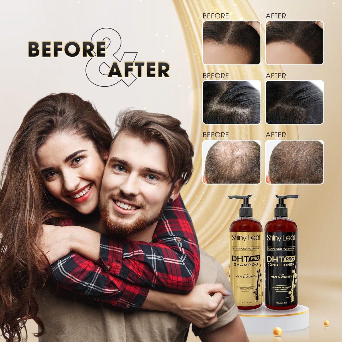 DHT Pro Shampoo and Conditioner Set - Advanced Hair Loss Solution with Procapil and Capixyl for Men and Women, Made in USA Avelisse