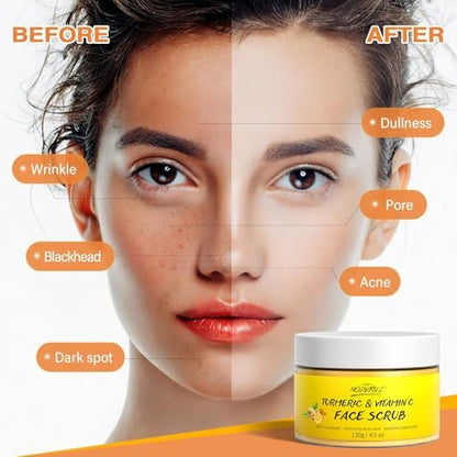 Vitamin C and Turmeric Face Scrub Cream – Organic Microdermabrasion Facial Scrub Exfoliator for Blackheads, Dark Spots, Acne – Strawberry Extract – 130g/4.5oz