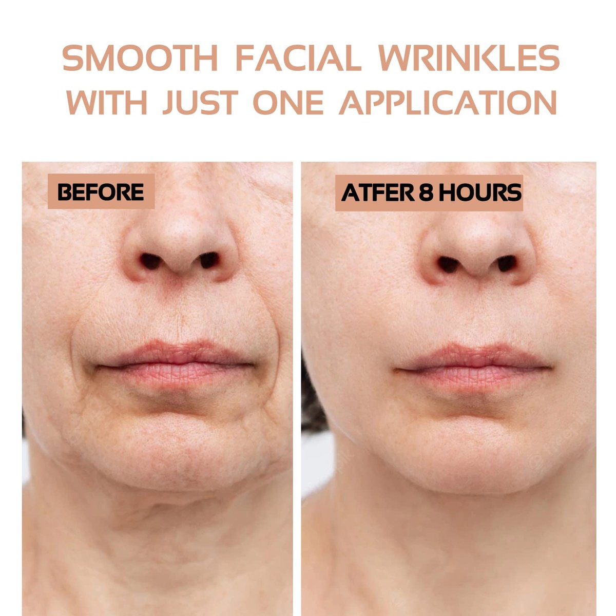 ENROSLU Face Wrinkle Patches 256Pcs - Clear Reusable Anti-Wrinkle Pads for Overnight Fine Line Removal - Smooth Eye, Mouth & Forehead - Train Facial Muscles for Smoother Skin - görsel 3