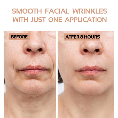 ENROSLU Face Wrinkle Patches 256Pcs - Clear Reusable Anti-Wrinkle Pads for Overnight Fine Line Removal - Smooth Eye, Mouth & Forehead - Train Facial Muscles for Smoother Skin