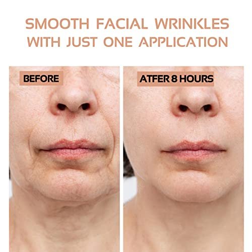 ENROSLU Face Wrinkle Patches 256Pcs - Clear Reusable Anti-Wrinkle Pads for Overnight Fine Line Removal - Smooth Eye, Mouth & Forehead - Train Facial Muscles for Smoother Skin - görsel 4
