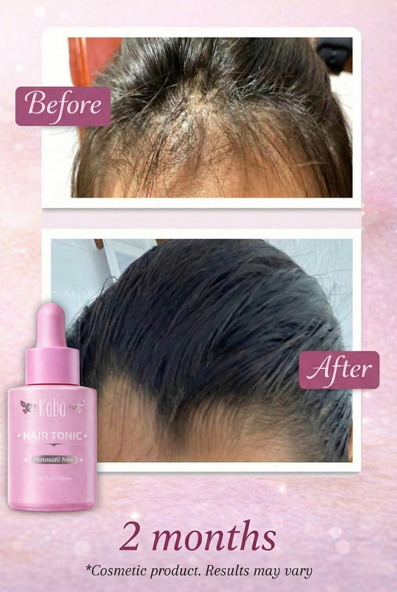 Kaba Tonic Hair Growth Serum – Hair Loss Treatment for Women, Growth Accelerator, Regrowth Treatment, Controls Oil, 1 oz Avelisse