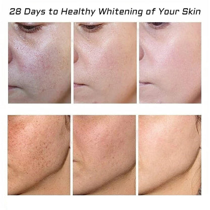 Whitening Freckle Cream 2-Pack – Acne Scar Removal & Pigmentation Treatment for Face, Moisturizing Dark Spot Corrector for Melasma, Wrinkles & Blemishes