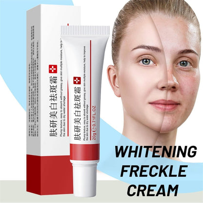 Whitening Freckle Cream 2-Pack – Acne Scar Removal & Pigmentation Treatment for Face, Moisturizing Dark Spot Corrector for Melasma, Wrinkles & Blemishes