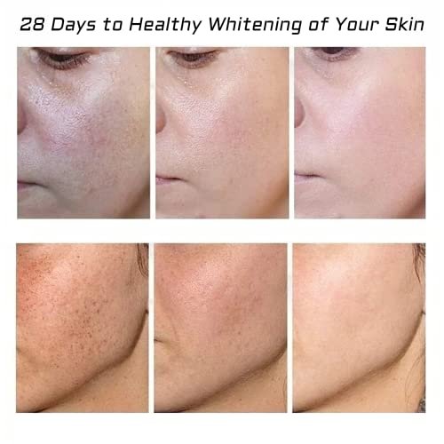 Whitening Freckle Cream 2-Pack – Acne Scar Removal & Pigmentation Treatment for Face, Moisturizing Dark Spot Corrector for Melasma, Wrinkles & Blemishes - görsel 6