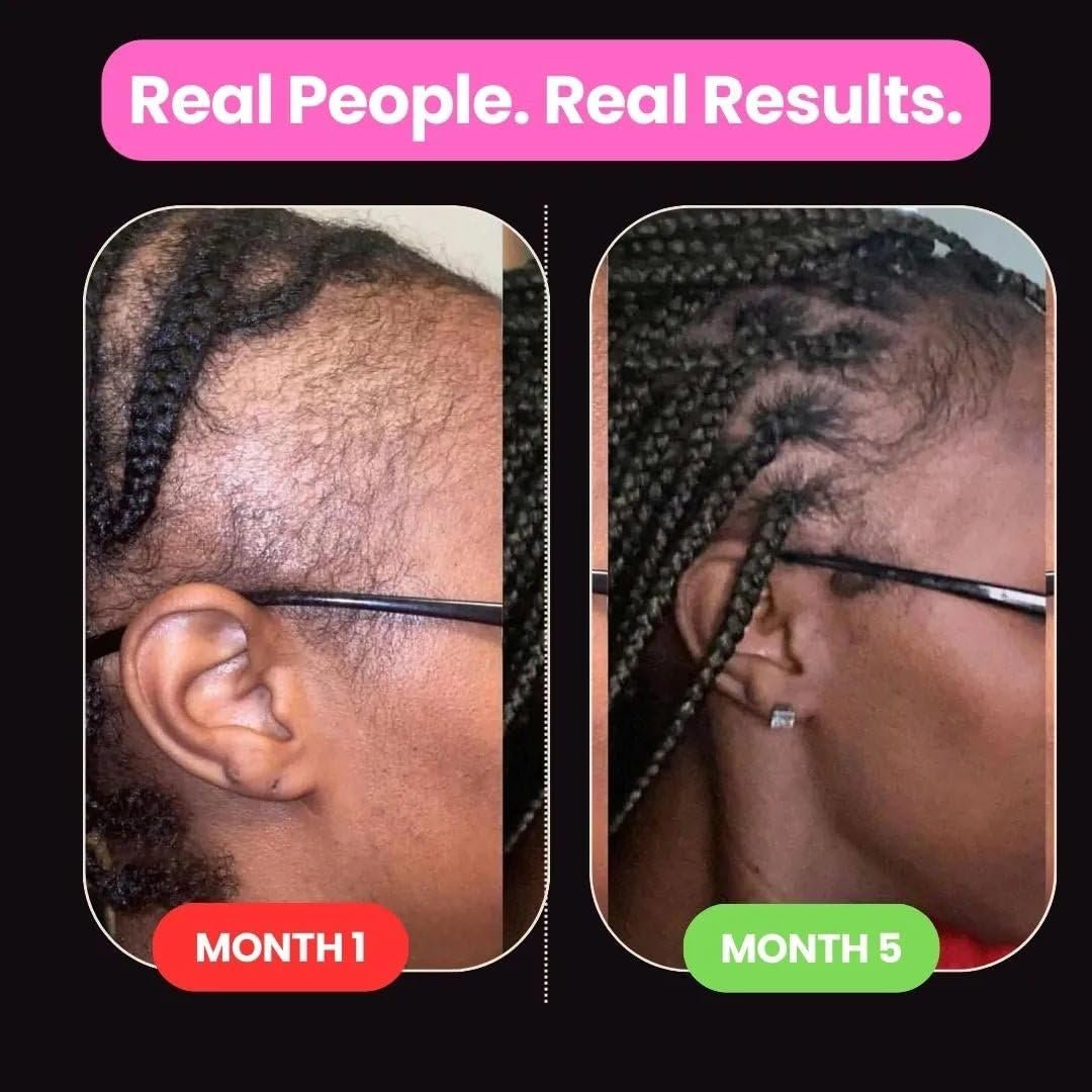 10 in 1 Hair Growth Oil with African Chebe Powder – Extreme Hair Growth Treatment, 2 Fl Oz Avelisse