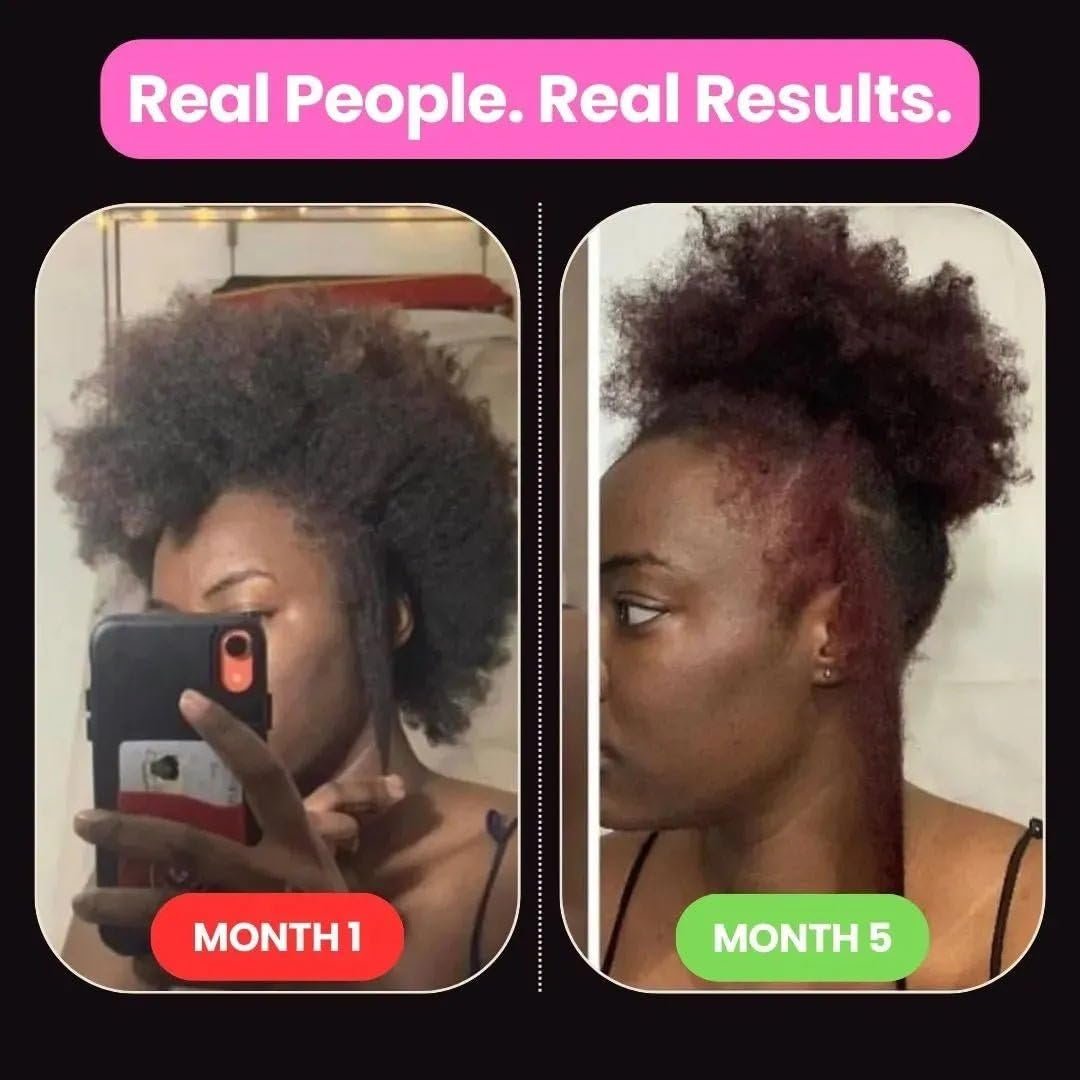 10 in 1 Hair Growth Oil with African Chebe Powder – Extreme Hair Growth Treatment, 2 Fl Oz Avelisse