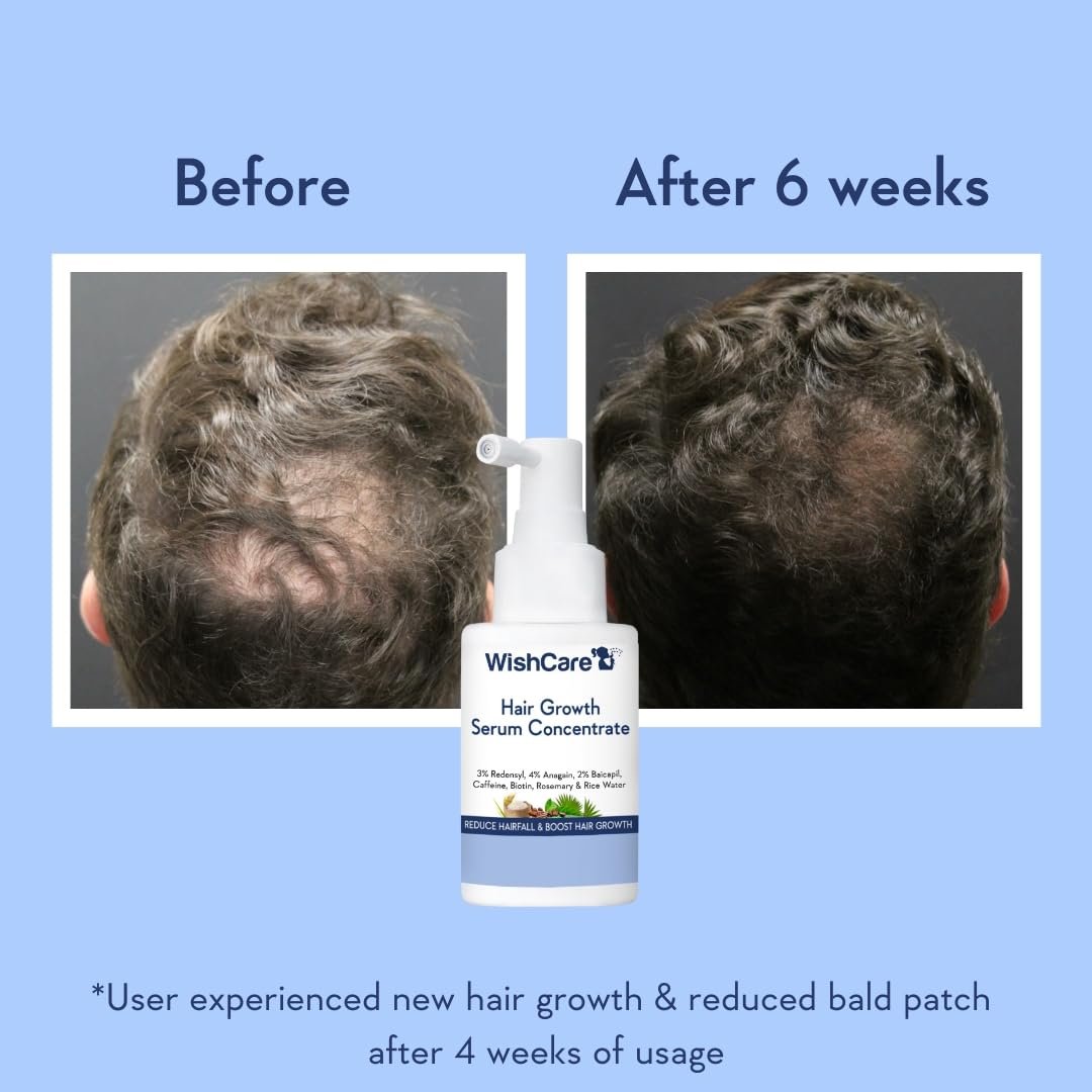 WishCare Hair Growth Serum Concentrate – Rosemary, 3% Redensyl, 4% Anagain, 2% Baicapil, Caffeine, Biotin, Plant Keratin & Rice Water - görsel 12