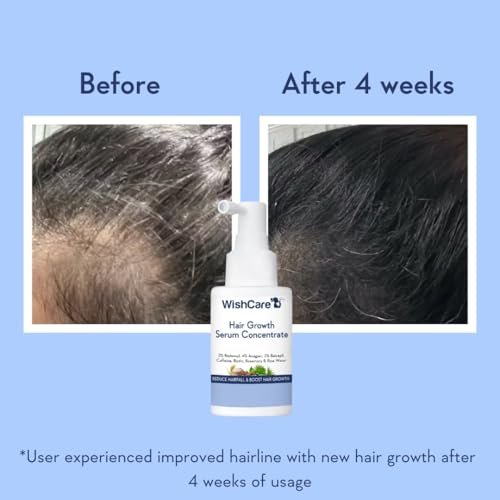 WishCare Hair Growth Serum Concentrate – Rosemary, 3% Redensyl, 4% Anagain, 2% Baicapil, Caffeine, Biotin, Plant Keratin & Rice Water - görsel 9