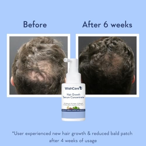 WishCare Hair Growth Serum Concentrate – Rosemary, 3% Redensyl, 4% Anagain, 2% Baicapil, Caffeine, Biotin, Plant Keratin & Rice Water - görsel 11