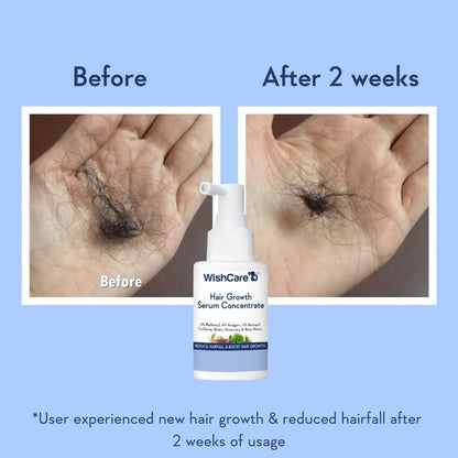 WishCare Hair Growth Serum Concentrate – Rosemary, 3% Redensyl, 4% Anagain, 2% Baicapil, Caffeine, Biotin, Plant Keratin & Rice Water
