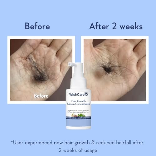 WishCare Hair Growth Serum Concentrate – Rosemary, 3% Redensyl, 4% Anagain, 2% Baicapil, Caffeine, Biotin, Plant Keratin & Rice Water - görsel 7