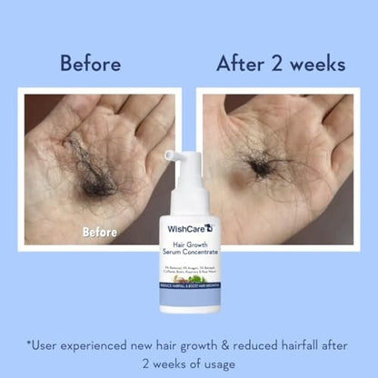WishCare Hair Growth Serum Concentrate – Rosemary, 3% Redensyl, 4% Anagain, 2% Baicapil, Caffeine, Biotin, Plant Keratin & Rice Water