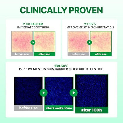 MAKE P:REM INTECA™ Soothing Cream – Advanced Non-Comedogenic Centella Asiatica Moisturizer for Acne-Prone & Sensitive Skin, Korean Vegan Face Cream, 2.70 fl oz Avelisse