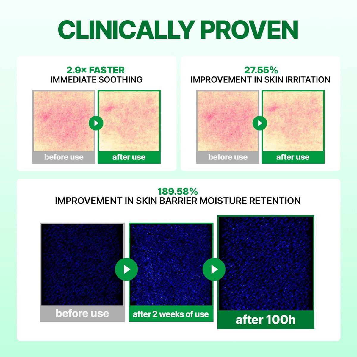 MAKE P:REM INTECA™ Soothing Cream – Advanced Non-Comedogenic Centella Asiatica Moisturizer for Acne-Prone & Sensitive Skin, Korean Vegan Face Cream, 2.70 fl oz Avelisse