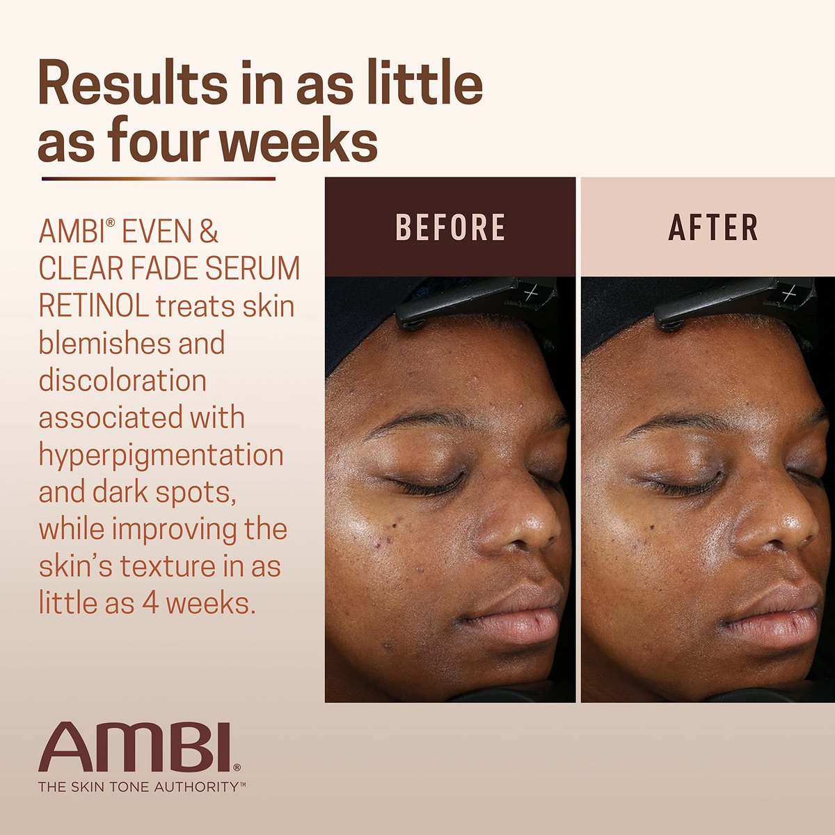 Ambi Even & Clear Fade Serum – Hydroquinone-Free Dark Spot Corrector with Retinol, Hyaluronic Acid, Niacinamide & Ceramides for Hyperpigmentation – 1 Fl Oz - görsel 9