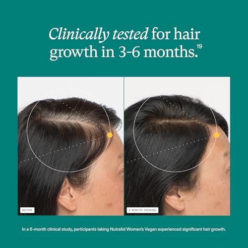 Nutrafol Women's Hair Growth Supplements – Clinically Tested for Thicker, Stronger Hair (Ages 18-44), 1-Month Supply Avelisse