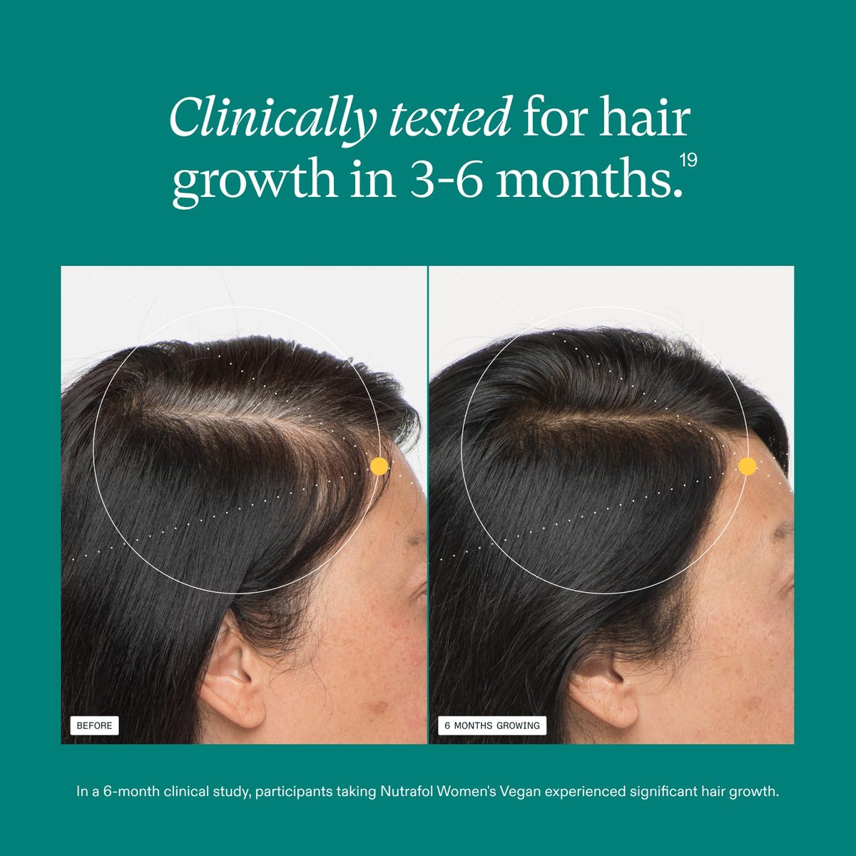 Nutrafol Women's Hair Growth Supplements – Clinically Tested for Thicker, Stronger Hair (Ages 18-44), 1-Month Supply Avelisse