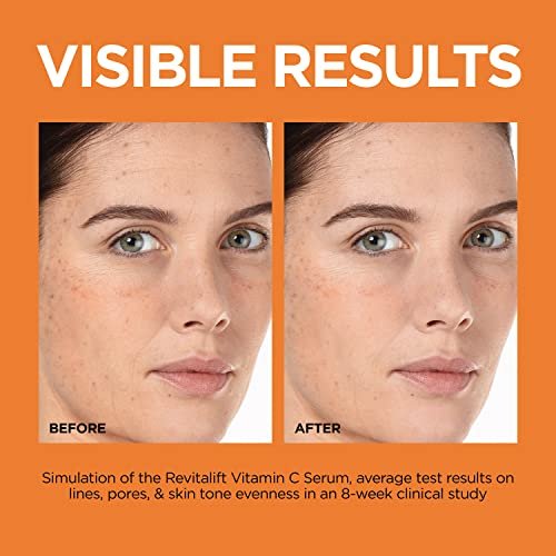 L'Oreal Paris Revitalift 12% Pure Vitamin C Serum with Vitamin E & Salicylic Acid - Brightening Face Serum, 1 oz + Moisturizer Sample Avelisse