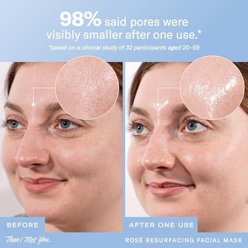 Then I Met You Rosé Resurfacing Facial Mask – Nourishing & Brightening AHA/BHA Acid Mask for Glass Skin, Vegan & Clean Skincare (1.76 oz) Avelisse