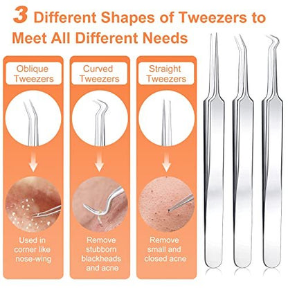 Professional Pimple Popper Tool Kit - 15 PCS Stainless Steel Blackhead Remover Comedone Extractor Tools for Acne Removal with Metal Case (Silver)