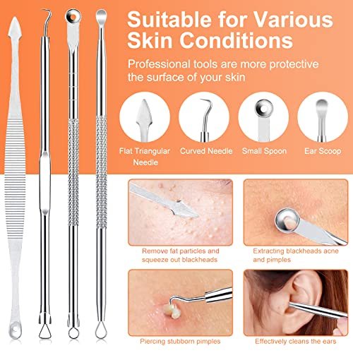 Professional Pimple Popper Tool Kit - 15 PCS Stainless Steel Blackhead Remover Comedone Extractor Tools for Acne Removal with Metal Case (Silver) - görsel 6