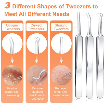 Professional Pimple Popper Tool Kit - 15 PCS Stainless Steel Blackhead Remover Comedone Extractor Tools for Acne Removal with Metal Case (Silver)