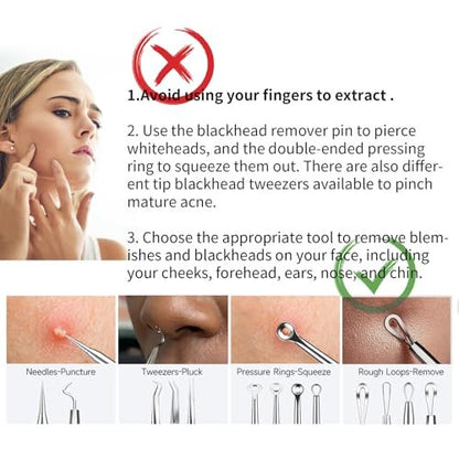 22-Piece Pimple Popper Tool Kit – Stainless Steel Blackhead Remover & Acne Comedone Extractor Set