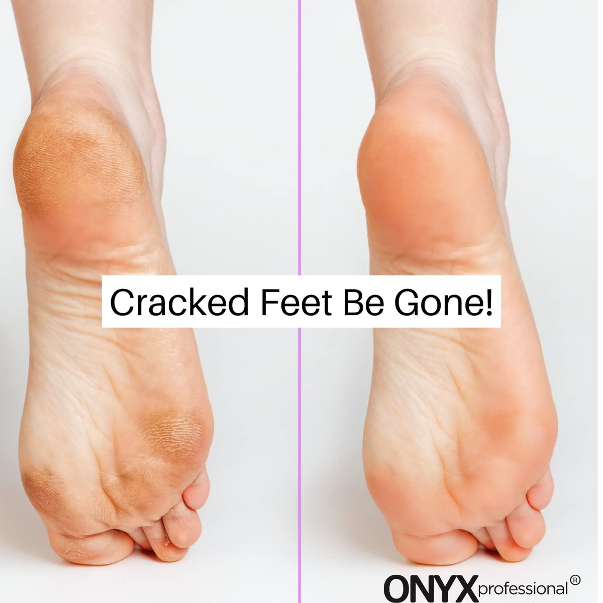 Onyx Professional Gel Moisturizing Socks – Hydrating Dry Feet Treatment for Cracked Heels, One Size Reusable Spa Socks for Women and Men - görsel 13
