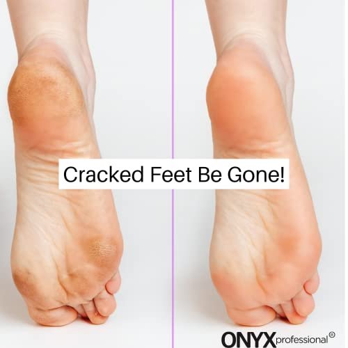 Onyx Professional Gel Moisturizing Socks – Hydrating Dry Feet Treatment for Cracked Heels, One Size Reusable Spa Socks for Women and Men - görsel 14