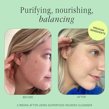 Brandefy Superfood Face Wash - Gentle pH Balanced Cleanser with Kale, Green Tea, Spinach, Vitamin C, E, K2 - Organic Facial Cleanser for All Skin Types (8 Fl Oz) Avelisse