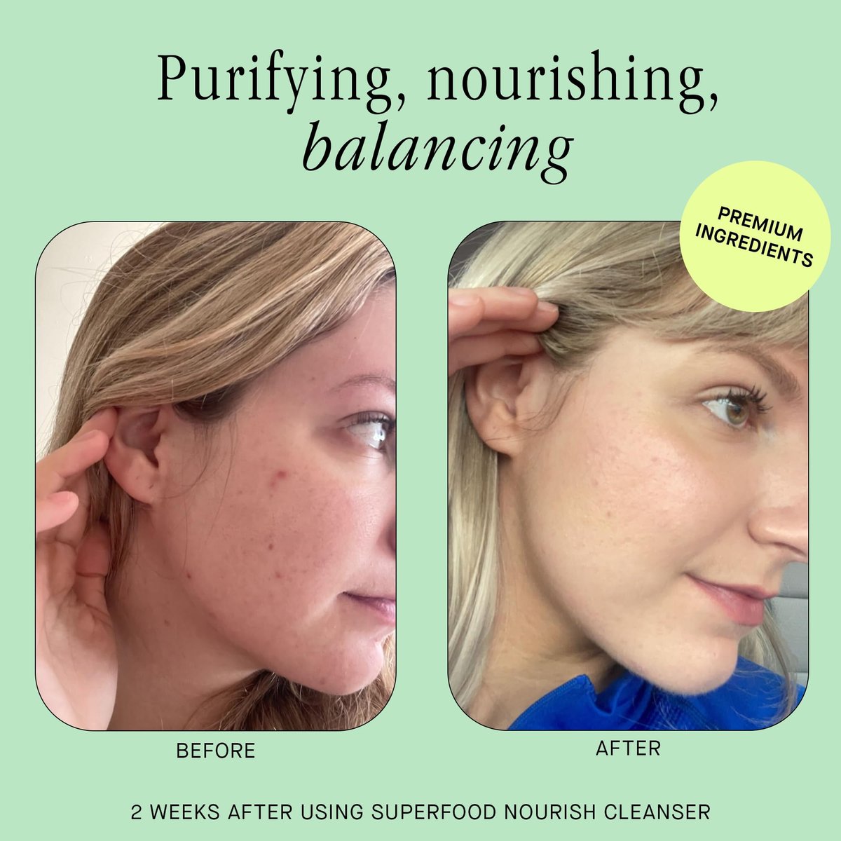 Brandefy Superfood Face Wash - Gentle pH Balanced Cleanser with Kale, Green Tea, Spinach, Vitamin C, E, K2 - Organic Facial Cleanser for All Skin Types (8 Fl Oz) Avelisse