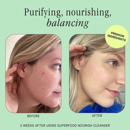 Brandefy Superfood Face Wash - Gentle pH Balanced Cleanser with Kale, Green Tea, Spinach, Vitamin C, E, K2 - Organic Facial Cleanser for All Skin Types (8 Fl Oz) Avelisse
