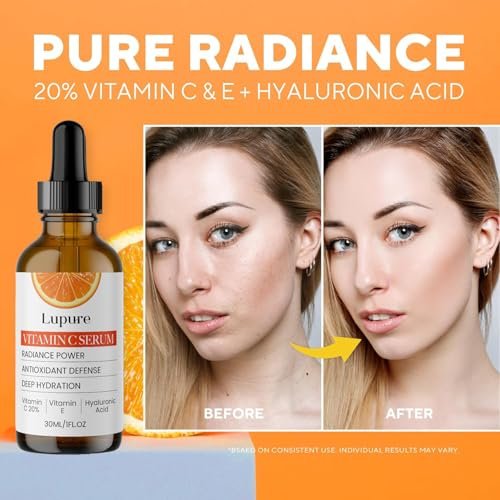 Lupure Professional Vitamin C Face Serum 20% – Anti Aging Serum with Ascorbic Acid, Hyaluronic Acid & Vitamin E for Dark Spots, 1 Fl Oz Avelisse
