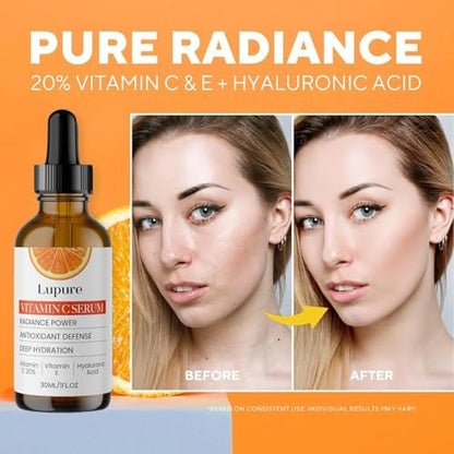 Lupure Professional Vitamin C Face Serum 20% – Anti Aging Serum with Ascorbic Acid, Hyaluronic Acid & Vitamin E for Dark Spots, 1 Fl Oz Avelisse