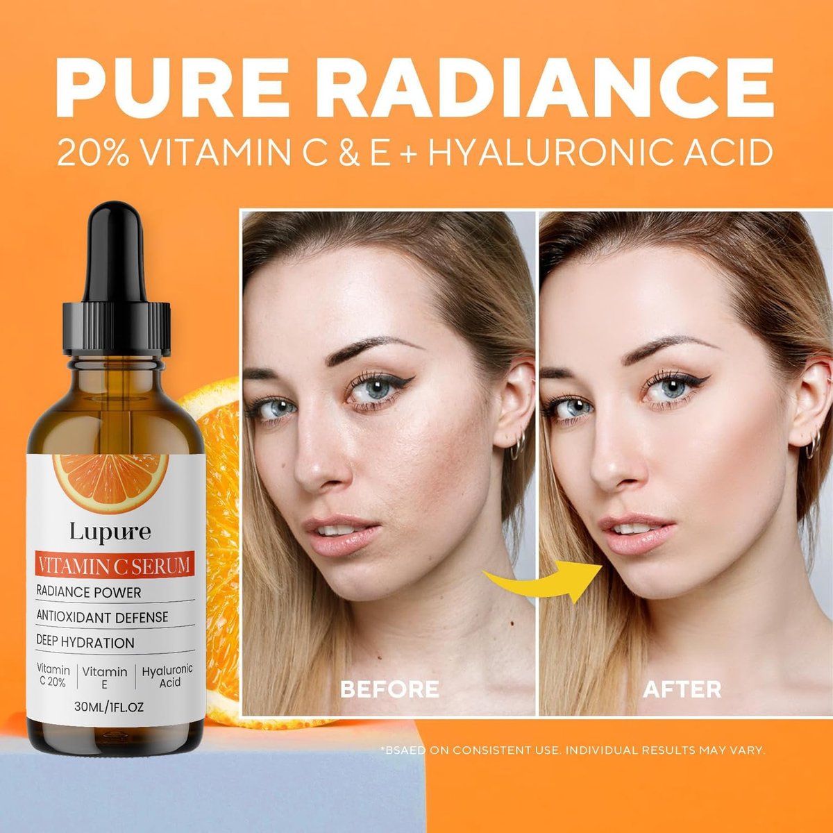 Lupure Professional Vitamin C Face Serum 20% – Anti Aging Serum with Ascorbic Acid, Hyaluronic Acid & Vitamin E for Dark Spots, 1 Fl Oz Avelisse