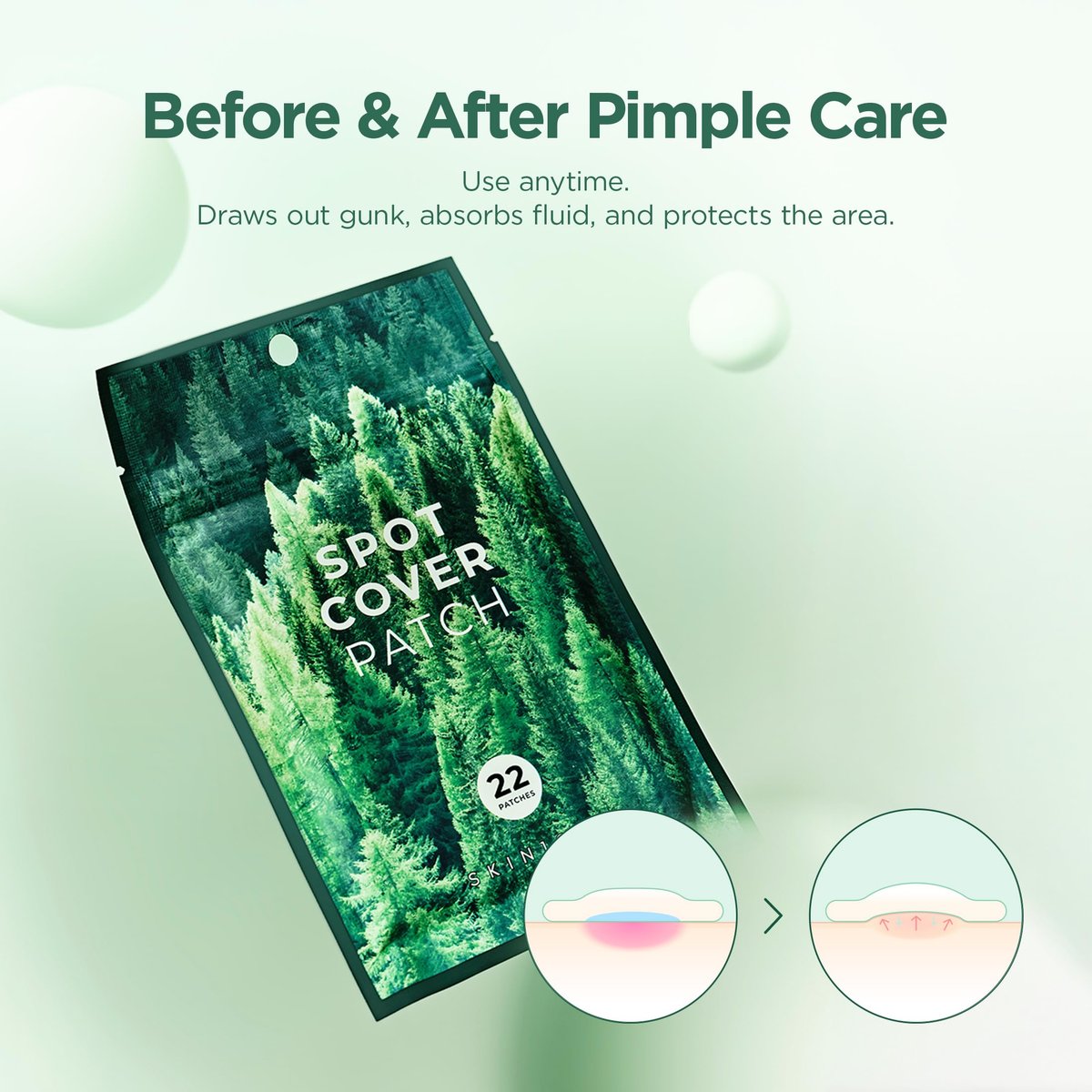 SKIN1004 Tea Trica Spot Cover Patch – Invisible Hydrocolloid Pimple Patches for Blemish Prone Skin, 22 Count - görsel 15