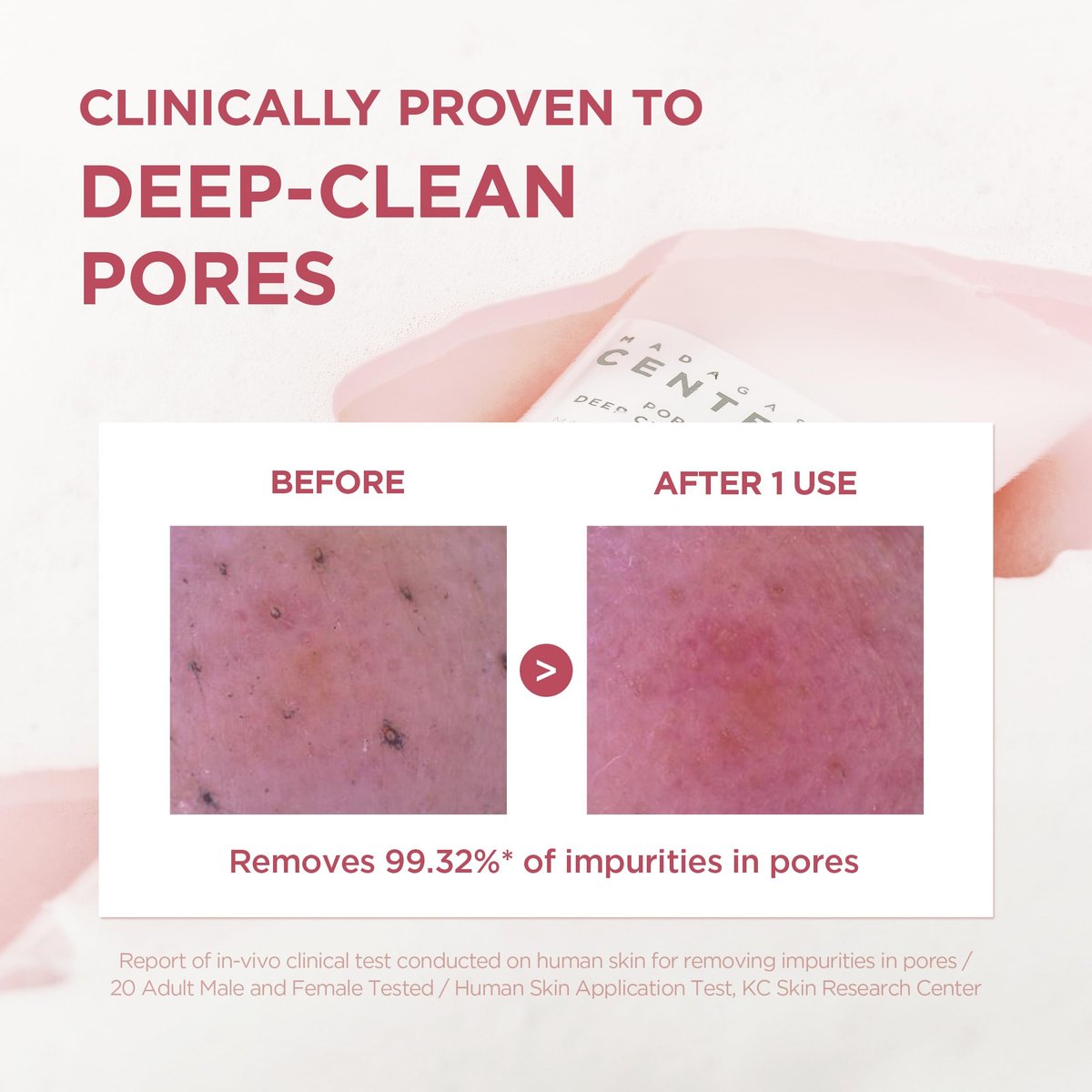SKIN1004 Poremizing Deep Cleansing Foam with Himalayan Pink Salt & Centella Asiatica - 4.23 fl.oz (125ml) Korean Face Cleanser for Pore Care Avelisse