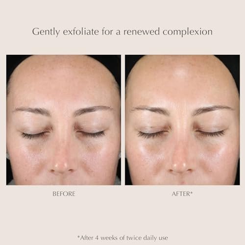 EXUVIANCE Gentle Daily Exfoliating Face Pads with PHA, Vitamin C & E, Green Tea & Cucumber Extracts, 60 Pads Avelisse