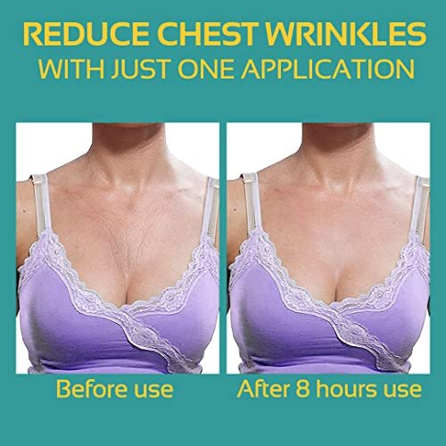 AGOPLEE Chest Wrinkle Pads - Pack of 5 Medical Grade Anti-Aging Skin Firming Patches for Décolleté & Neck Avelisse