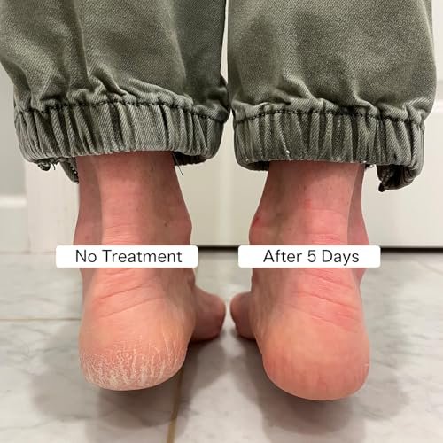 Pedestrian Project Cracked Heel Repair Foot Care Balm – Smooths & Fills Cracks with Shea & Mango Butters, Vegan & Cruelty Free, 1 oz Avelisse