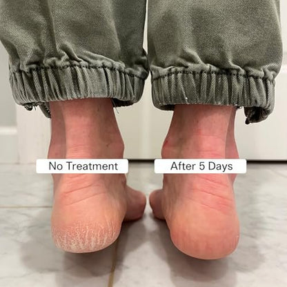 Pedestrian Project Cracked Heel Repair Foot Care Balm – Smooths & Fills Cracks with Shea & Mango Butters, Vegan & Cruelty Free, 1 oz Avelisse