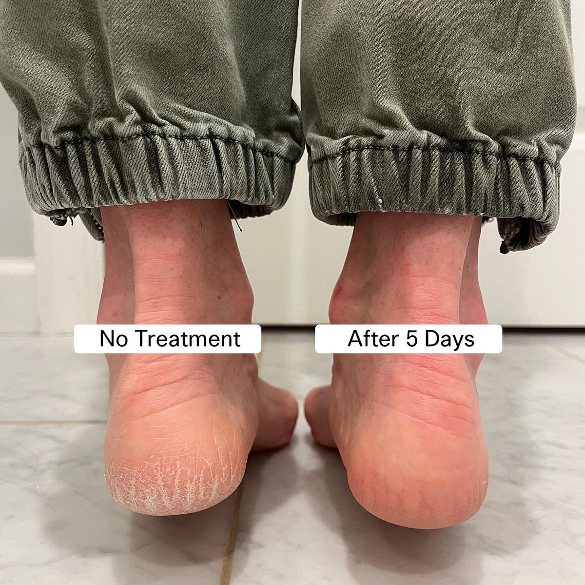 Pedestrian Project Cracked Heel Repair Foot Care Balm – Smooths & Fills Cracks with Shea & Mango Butters, Vegan & Cruelty Free, 1 oz Avelisse