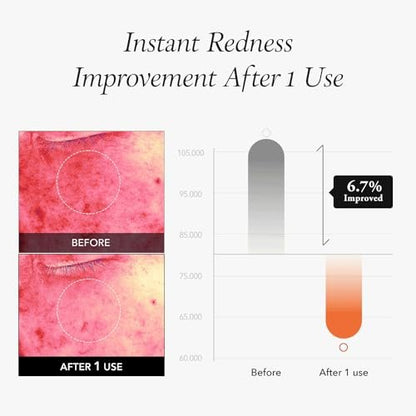 APRILSKIN Carrotene IPMP™ Instant Calming Serum Toner Pads – 80 Pads Vegan Korean Skin Care