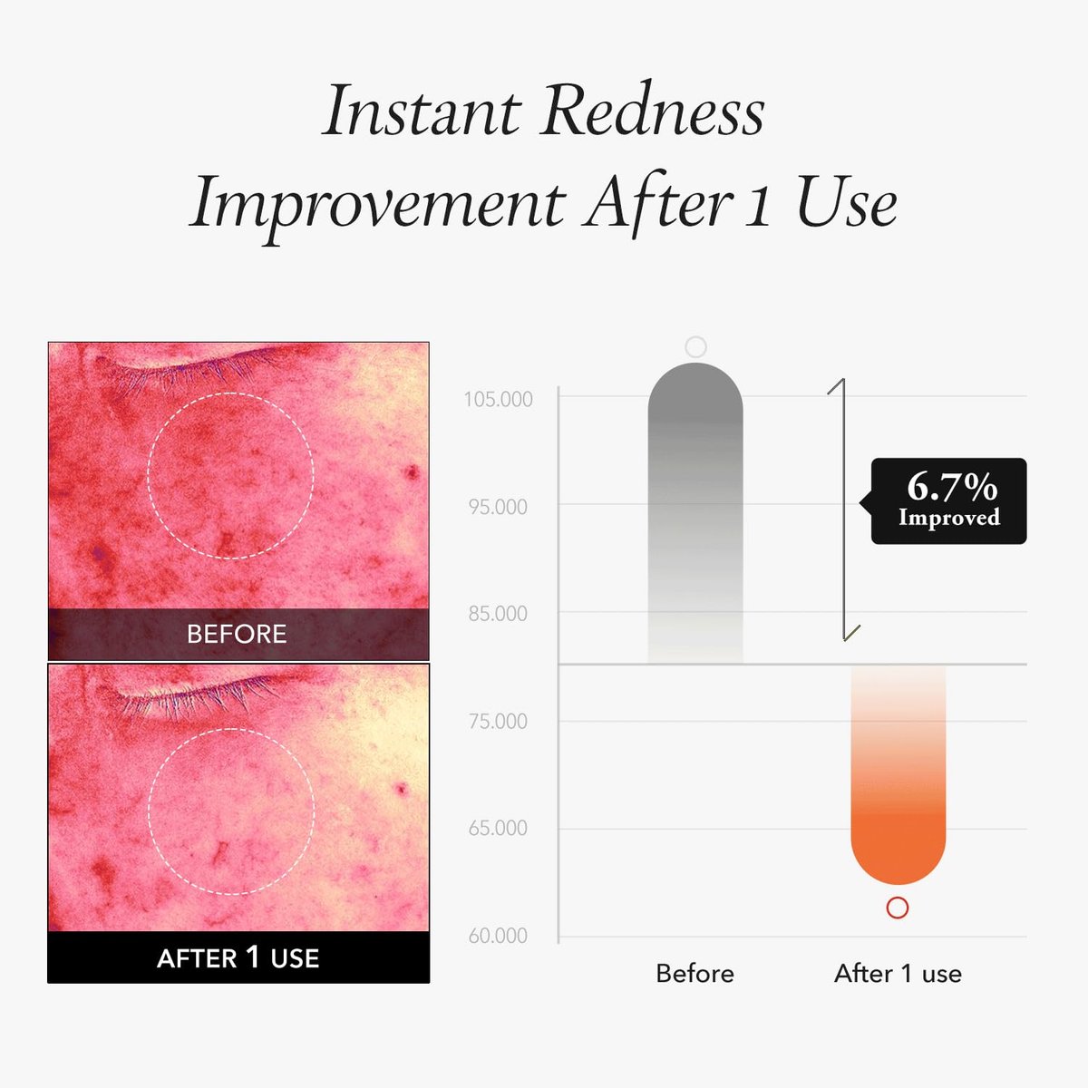 APRILSKIN Carrotene IPMP™ Instant Calming Serum Toner Pads – 80 Pads Vegan Korean Skin Care - görsel 7