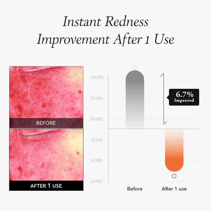 APRILSKIN Carrotene IPMP™ Instant Calming Serum Toner Pads – 80 Pads Vegan Korean Skin Care