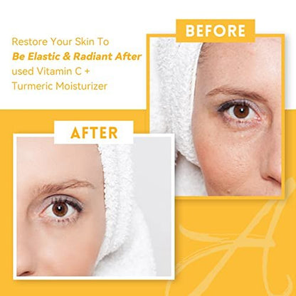 ANAI RUI Turmeric Face Cream with Vitamin C – Hydrating, Firming & Brightening Moisturizer for Dark Spots & Dry Skin (1.76 oz)